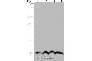 Western blot analysis of SKOV3 cell and human fetal liver tissue, human fetal brain tissue and Hela cell, using NDUFA4 Polyclonal Antibody at dilution of 1:300 (NDUFA4 抗体)
