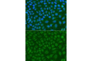 Immunofluorescence analysis of A549 cell using SSX5 antibody. (SSX5 抗体)