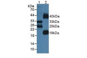 Western blot analysis of (1) Mouse Lung Tissue and (2) Mouse Testis Tissue. (FLT3LG 抗体  (AA 27-189))
