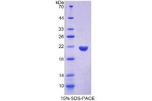 SDS-PAGE analysis of Rat PTPN13 Protein. (PTPN13 蛋白)