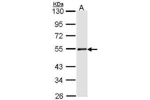 WB Image Sample (30 ug of whole cell lysate) A: H1299 10% SDS PAGE antibody diluted at 1:1000 (RAD23A 抗体  (Center))
