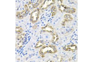 Immunohistochemistry of paraffin-embedded rat kidney using CDCA8 antibody (ABIN6290179) at dilution of 1:100 (40x lens). (CDCA8 抗体)