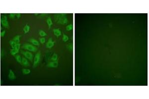 Immunofluorescence analysis of A549 cells, using Stefin A antibody. (CSTA 抗体  (Internal Region))