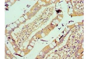 Immunohistochemistry of paraffin-embedded human small intestine tissue using ABIN7175561 at dilution of 1:100