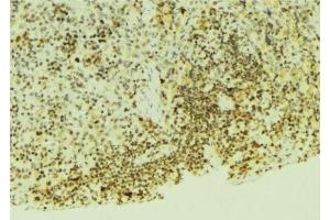 ABIN6276554 at 1/100 staining Mouse pancreas tissue by IHC-P. (EGLN1 抗体  (Internal Region))