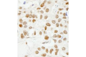 Immunohistochemistry (IHC) image for anti-KH Domain Containing, RNA Binding, Signal Transduction Associated 1 (KHDRBS1) (AA 1-50) antibody (ABIN7448786)