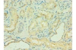 Immunohistochemistry of paraffin-embedded human kidney tissue using ABIN7146168 at dilution of 1:100 (C4BPB 抗体  (AA 18-252))