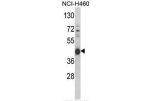 Western blot analysis of PRKACA Antibody (N-term K82) in NCI-H460 cell line lysates (35ug/lane). (PRKACA 抗体  (N-Term))