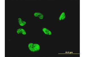 Immunofluorescence of monoclonal antibody to CGGBP1 on HeLa cell. (CGGBP1 抗体  (AA 58-167))