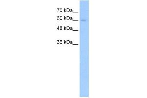 WB Suggested Anti-TGFBR2 Antibody Titration:  5.