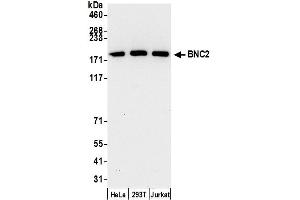 Western Blotting (WB) image for anti-Basonuclin 2 (BNC2) (AA 350-400) antibody (ABIN7453047)