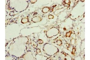 Immunohistochemistry of paraffin-embedded human thyroid tissue using ABIN7142705 at dilution of 1:100 (PGLS 抗体  (AA 1-258))