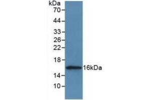Detection of Recombinant CSTA, Human using Polyclonal Antibody to Cystatin A (CSTA) (CSTA 抗体  (AA 1-98))