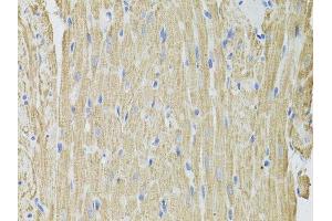 Immunohistochemistry of paraffin-embedded rat heart using FHIT antibody. (FHIT 抗体  (AA 25-147))