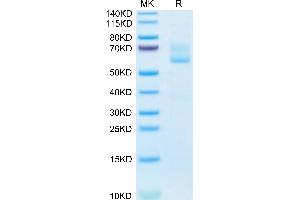 Mouse EFEMP1 on Tris-Bis PAGE under reduced condition. (FBLN3 Protein (AA 18-493) (His tag))