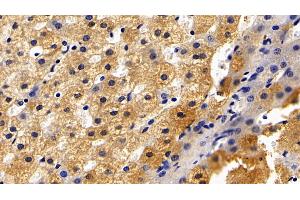 Detection of CRP in Porcine Liver Tissue using Polyclonal Antibody to C Reactive Protein (CRP) (CRP 抗体  (AA 20-222))