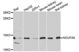 Western blot analysis of extracts of various cell lines, using NDUFA6 antibody (ABIN6003563) at 1/1000 dilution. (NDUFA6 抗体)