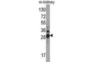 Western Blotting (WB) image for anti-Dimethylarginine Dimethylaminohydrolase 1 (DDAH1) antibody (ABIN3001702) (DDAH1 抗体)