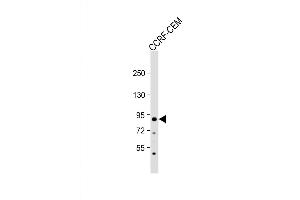 Western Blot at 1:2000 dilution + CCRF-CEM whole cell lysate Lysates/proteins at 20 ug per lane. (MDM2 抗体  (AA 141-176))