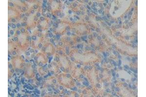 DAB staining on IHC-P; Samples: Rat Kidney Tissue (DGKG 抗体  (AA 287-524))