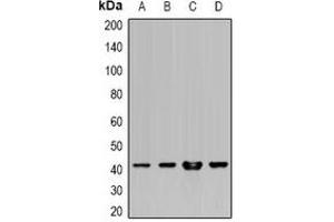 Western blot analysis of HLA-A expression in Hela (A), SW480 (B), HepG2 (C), mouse liver (D) whole cell lysates. (HLA-A 抗体)