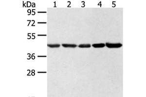 Western blot analysis of Hela lncap NIH/3T3 K562 and 231 cell using WDR77 Polyclonal Antibody at dilution of 1:500 (WDR77 抗体)
