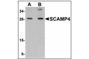 Western blot analysis of SCAMP4 in 3T3 cell lysate with SCAMP4 antibody at (A) 1 and (B) 2 µg/ml. (SCAMP4 抗体  (C-Term))