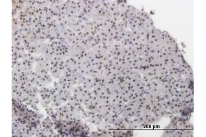 Immunoperoxidase of monoclonal antibody to ATF2 on formalin-fixed paraffin-embedded human pancreas. (ATF2 抗体  (AA 241-340))