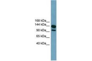 Image no. 1 for anti-Leucine Rich Repeat Containing 66 (LRRC66) (AA 575-624) antibody (ABIN6744784) (LRRC66 抗体  (AA 575-624))