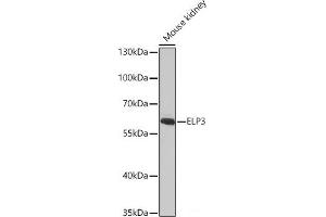 Western blot analysis of extracts of Mouse kidney using ELP3 Polyclonal Antibody at dilution of 1:1000. (ELP3/KAT9 抗体)