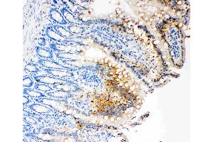IHC analysis of Caspase-3 (P17)using anti- Caspase-3 (P17)antibody . (Caspase 3 抗体  (N-Term))