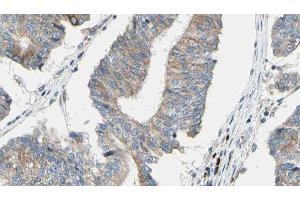 ABIN6276563 at 1/100 staining Human prostate tissue by IHC-P. (ACTN1 抗体  (N-Term))