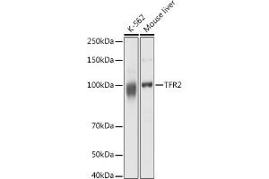 Western blot analysis of extracts of various cell lines, using TFR2 antibody (ABIN6128863, ABIN6149063, ABIN6149064 and ABIN6225172) at 1:1000 dilution. (Transferrin Receptor 2 抗体  (AA 582-801))