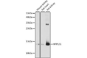 Western blot analysis of extracts of various cell lines, using MRPL51 antibody (ABIN7268577) at 1:1000 dilution. (MRPL51 抗体  (AA 1-128))