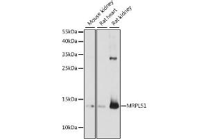 Western blot analysis of extracts of various cell lines, using MRPL51 antibody (ABIN7268577) at 1:1000 dilution.