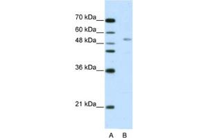 Western Blotting (WB) image for anti-G-Rich RNA Sequence Binding Factor 1 (GRSF1) antibody (ABIN2462114) (GRSF1 抗体)