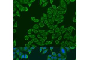 Immunofluorescence (IF) image for anti-Ribosomal Protein L36 (RPL36) antibody (ABIN7263819)