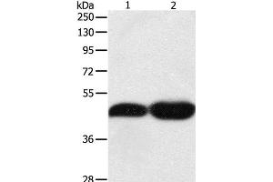 Western Blot analysis of NIH/3T3 and Lncap cell using TEKT1 Polyclonal Antibody at dilution of 1:500 (TEKT1 抗体)