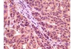 Immunohistochemistry (IHC) image for anti-Glycogen Synthase Kinase 3 alpha (GSK3a) (truncated) antibody (ABIN2464059) (GSK3 alpha 抗体  (truncated))