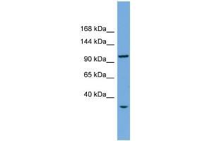 Western Blotting (WB) image for anti-CTF18, Chromosome Transmission Fidelity Factor 18 Homolog (CHTF18) (Middle Region) antibody (ABIN2787289)