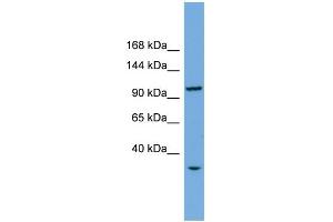 WB Suggested Anti-CHTF18 Antibody Titration: 0. (CTF18 抗体  (Middle Region))