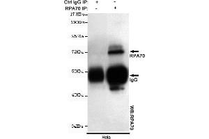 Immunoprecipitation analysis of Hela cell lysates using R mouse mAb. (RPA1 抗体)