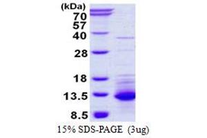 SDS-PAGE (SDS) image for Chemokine (C-X-C Motif) Ligand 11 (CXCL11) (AA 22-94) protein (His tag) (ABIN666799) (CXCL11 Protein (AA 22-94) (His tag))