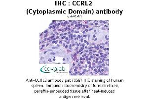 Image no. 1 for anti-Chemokine (C-C Motif) Receptor-Like 2 (CCRL2) (3rd Cytoplasmic Domain) antibody (ABIN1732793)