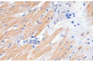 Immunohistochemistry of paraffin-embedded Rat heart using PDCD2L Polyclonal Antibody at dilution of 1:100 (40x lens). (PDCD2L 抗体)