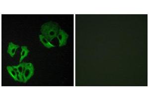 Immunofluorescence (IF) image for anti-MAP-Kinase Activating Death Domain (MADD) (Internal Region) antibody (ABIN1849836) (MADD 抗体  (Internal Region))