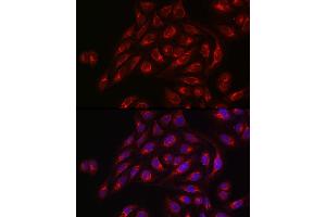Immunofluorescence analysis of U2OS cells using TLR1 Rabbit pAb (ABIN3023654, ABIN3023655, ABIN3023656 and ABIN6214092) at dilution of 1:50 (40x lens). (TLR1 抗体  (AA 30-290))
