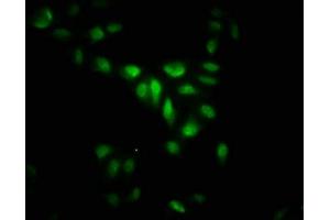 Immunofluorescence staining of Hela cells with ABIN7158992 at 1: 266, counter-stained with DAPI. (MAPKAP Kinase 5 抗体  (AA 200-471))