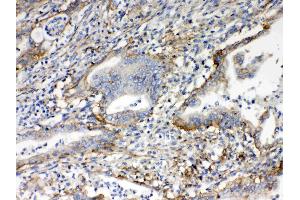 IHC analysis of CD151 using anti- CD151 antibody .