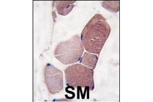 Formalin-fixed and paraffin-embedded human skeletal muscle tissue reacted with UCHL3 Antibody (C-term) (ABIN1882147 and ABIN2839167) , which was peroxidase-conjugated to the secondary antibody, followed by DAB staining. (UCHL3 抗体  (C-Term))
